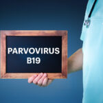 Parvovirus B19