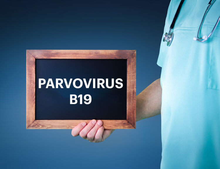 Parvovirus B19