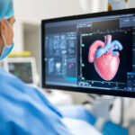 The Impact of Market Research On the Future of Interventional Cardiology