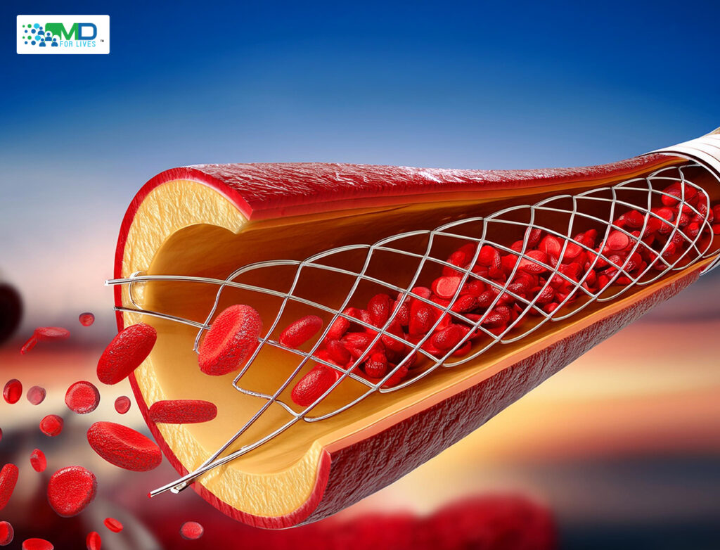 future of interventional cardiology