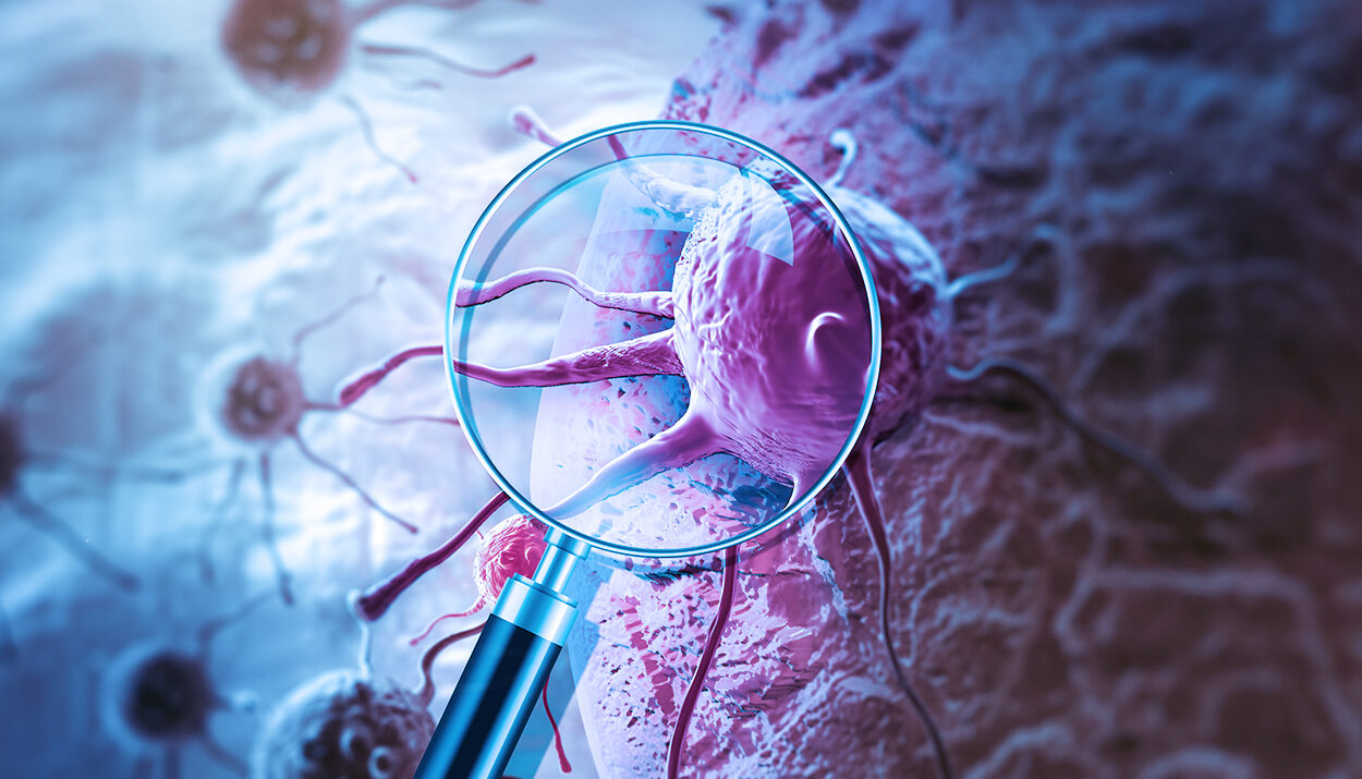 Preemptive and Empirical Treatment