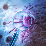 Preemptive and Empirical Treatment