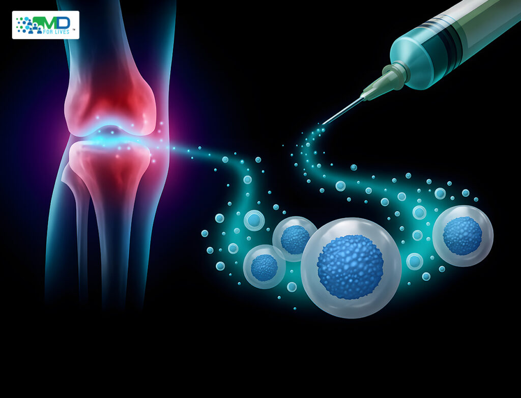 Bioactive glass for bone regeneration