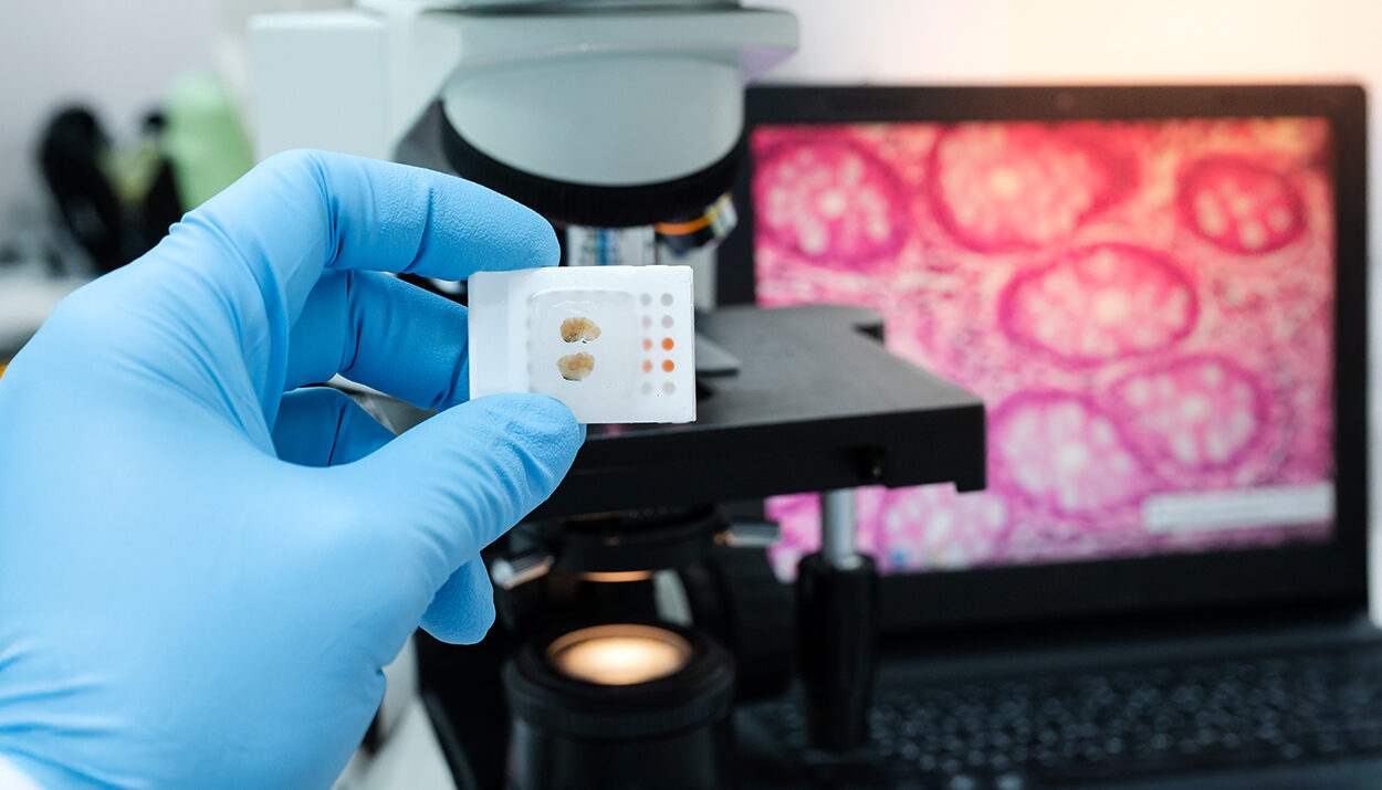 Digital Pathology and AI