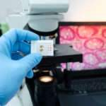 Digital Pathology and AI