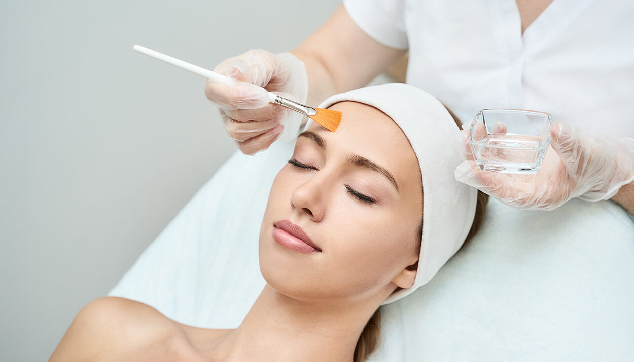 facial chemical peels