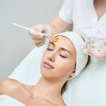 facial chemical peels