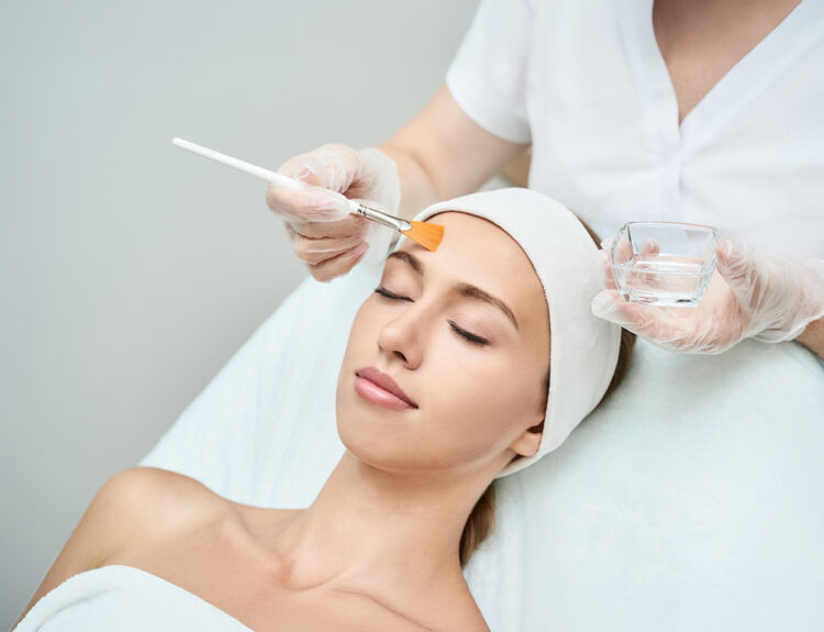 facial chemical peels