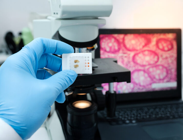 Digital Pathology and AI