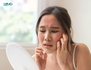 risks of chemical peels