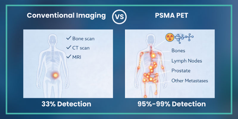 comparison of psma pet scan and conventional imaging in prostate cancer detection