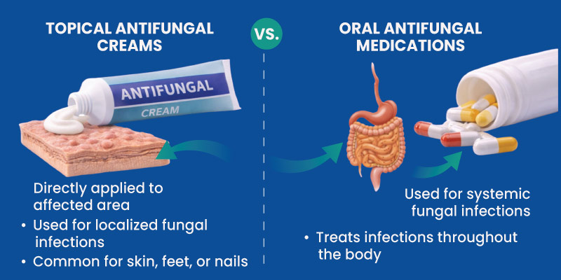 topical and oral antifungal medications used to treat fungal infections