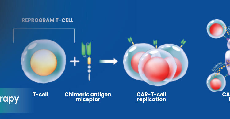 Diagram showing engineered CAR T cells attacking cancer cells in immunotherapy