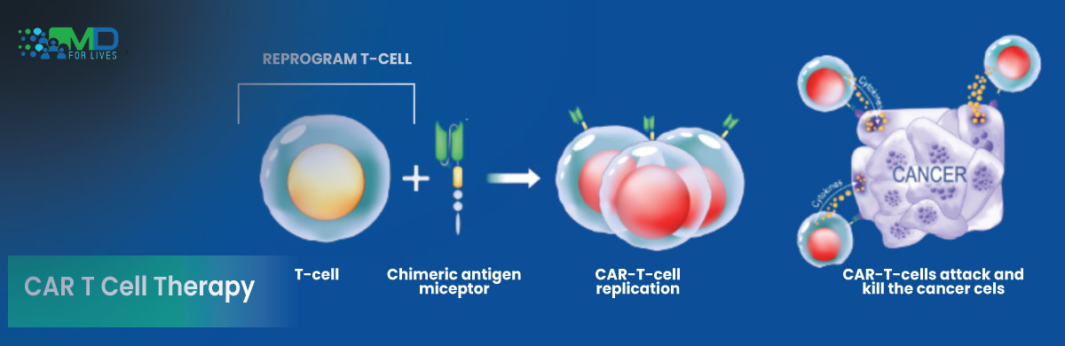 Diagram showing engineered CAR T cells attacking cancer cells in immunotherapy