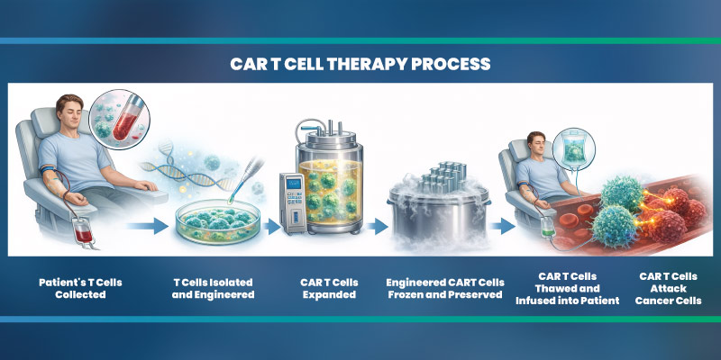 CAR T Cell Therapy Process