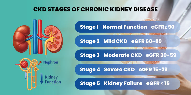 diagram explaining ckd stages from stage 1 to stage 5 based on egfr levels