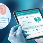 doctor reviewing eGFR blood test results to measure kidney function