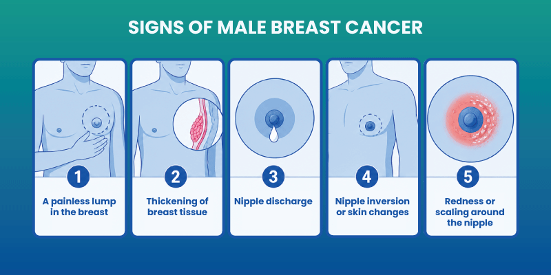 male breast cancer symptoms including lump nipple changes and discharge 