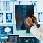 osteosarcoma treatment consultation showing doctor reviewing bone scan with patient