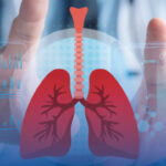 alpha 1 antitrypsin deficiency affecting lungs and liver