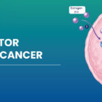Estrogen Receptor Positive Breast Cancers