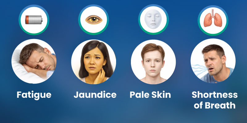 Infographic showing common hemolytic anemia symptoms including fatigue and jaundice