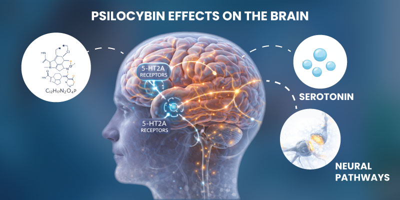 Brain diagram showing how psilocybin therapy affects serotonin receptors