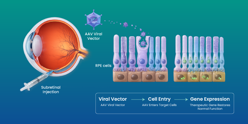 retinal gene therapy mechanism showing gene delivery to eye cells