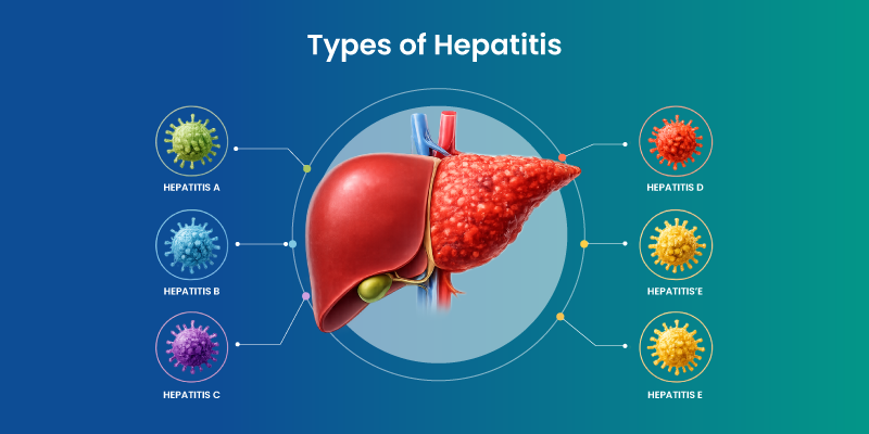 types of hepatitis a b c d e affecting liver