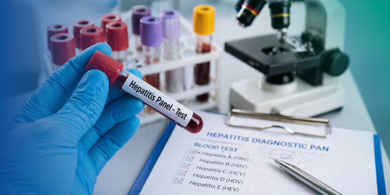 hepatitis diagnostic tests using blood sample analysis