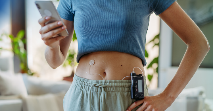 Insulin Pump and CGM