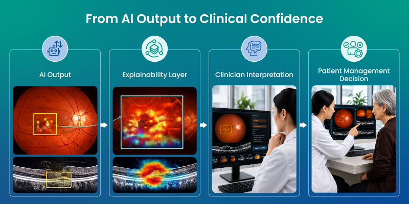 AI ophthalmic imaging output moving through explainability clinician review and patient management decision
