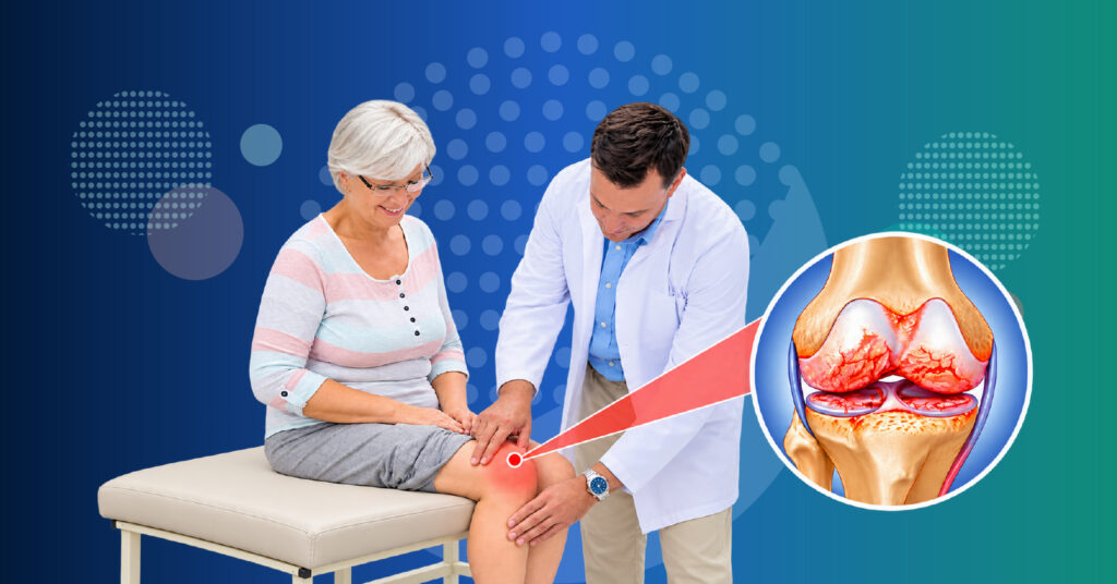 Knee joint showing osteoarthritis-related cartilage damage and healthier cartilage as researchers investigate cartilage regeneration.