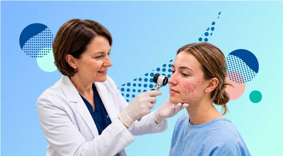 Adult Acne Management- When Hormones, Tolerability, and Relapse Shape Treatment